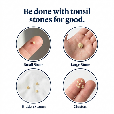 Tonsil Stone Cleaner - Deep Clean & Protective Barrier
