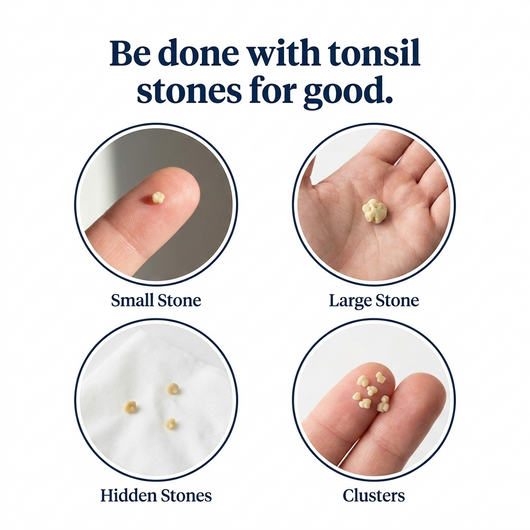 Tonsil Stone Cleaner - Deep Clean & Protective Barrier